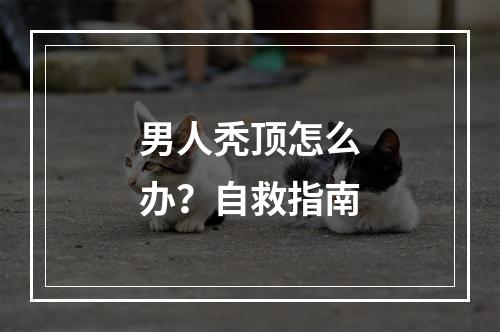 男人秃顶怎么办？自救指南