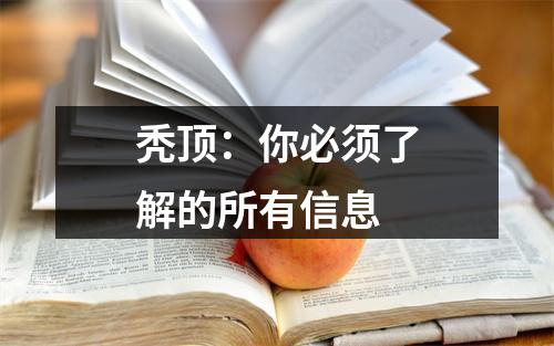 秃顶：你必须了解的所有信息