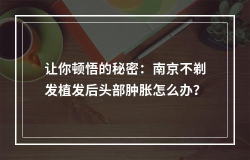 让你顿悟的秘密：南京不剃发植发后头部肿胀怎么办？