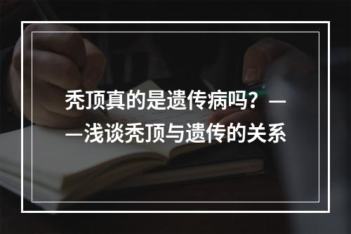 秃顶真的是遗传病吗？——浅谈秃顶与遗传的关系