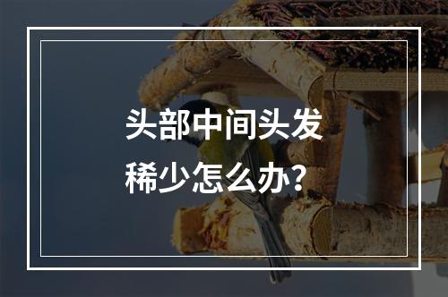 头部中间头发稀少怎么办？