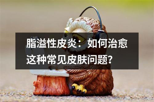 脂溢性皮炎：如何治愈这种常见皮肤问题？