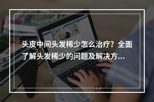 头皮中间头发稀少怎么治疗？全面了解头发稀少的问题及解决方法