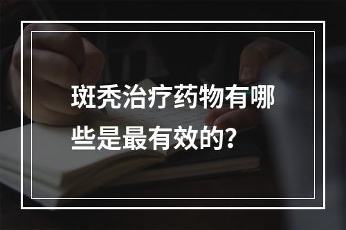 斑秃治疗药物有哪些是最有效的？