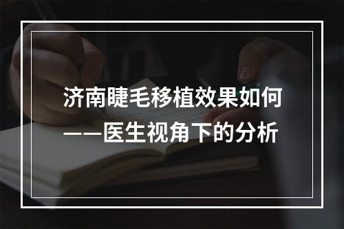 济南睫毛移植效果如何——医生视角下的分析