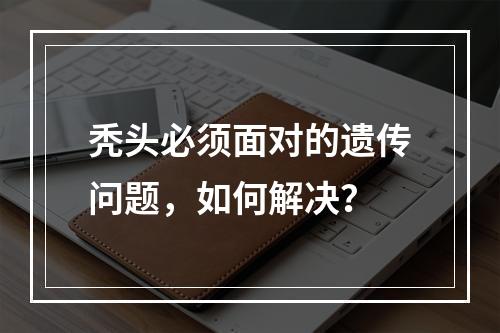 秃头必须面对的遗传问题，如何解决？