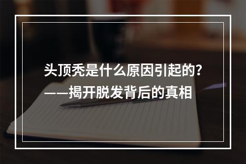 头顶秃是什么原因引起的？——揭开脱发背后的真相