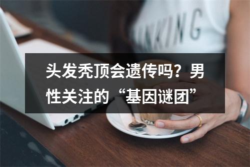 头发秃顶会遗传吗？男性关注的“基因谜团”