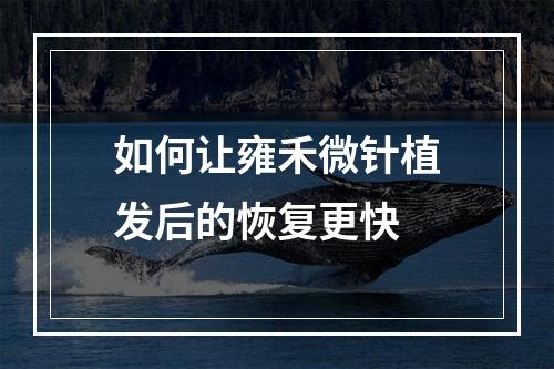 如何让雍禾微针植发后的恢复更快