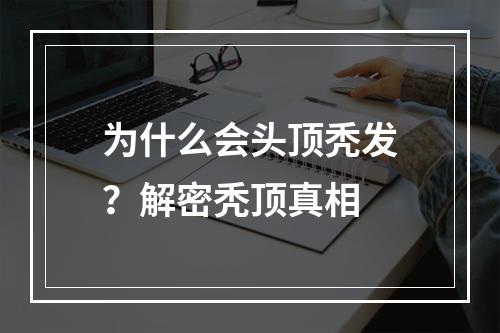 为什么会头顶秃发？解密秃顶真相