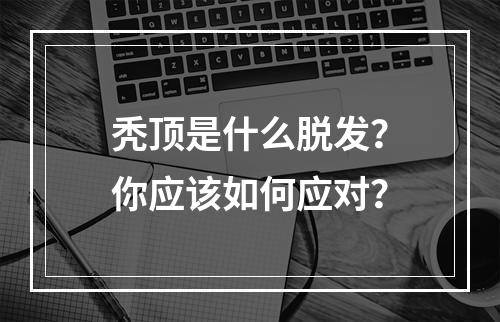 秃顶是什么脱发？你应该如何应对？