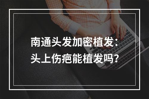 南通头发加密植发：头上伤疤能植发吗？