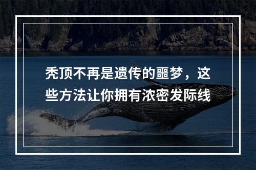 秃顶不再是遗传的噩梦，这些方法让你拥有浓密发际线