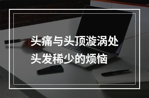 头痛与头顶漩涡处头发稀少的烦恼