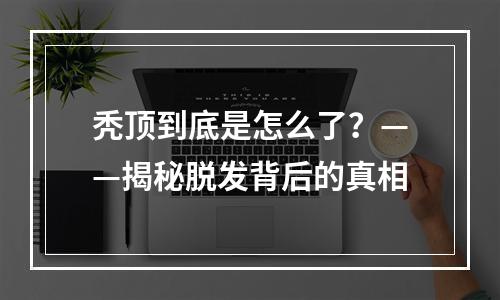 秃顶到底是怎么了？——揭秘脱发背后的真相