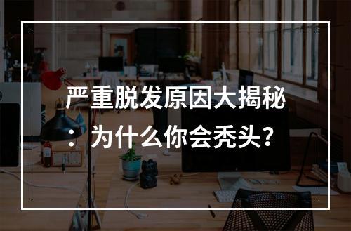 严重脱发原因大揭秘：为什么你会秃头？