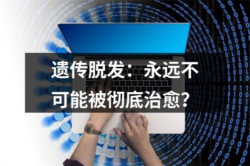 遗传脱发：永远不可能被彻底治愈？