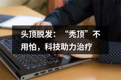 头顶脱发：“秃顶”不用怕，科技助力治疗