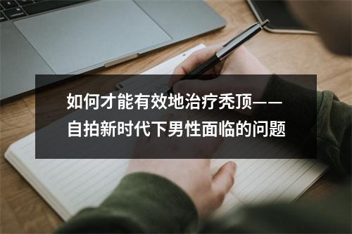 如何才能有效地治疗秃顶——自拍新时代下男性面临的问题