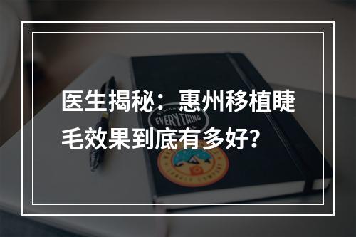 医生揭秘：惠州移植睫毛效果到底有多好？