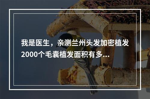 我是医生，亲测兰州头发加密植发2000个毛囊植发面积有多大