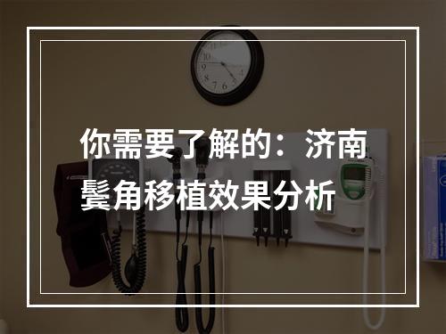 你需要了解的：济南鬓角移植效果分析