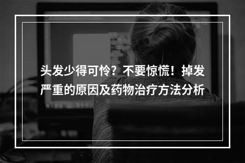 头发少得可怜？不要惊慌！掉发严重的原因及药物治疗方法分析