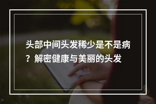 头部中间头发稀少是不是病？解密健康与美丽的头发