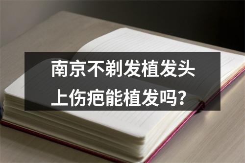 南京不剃发植发头上伤疤能植发吗？