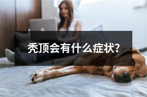 秃顶会有什么症状？