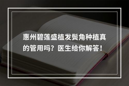 惠州碧莲盛植发鬓角种植真的管用吗？医生给你解答！