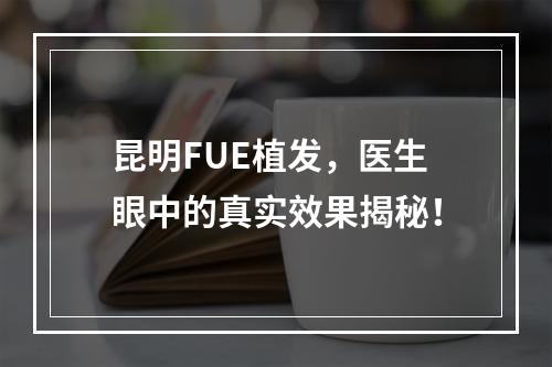 昆明FUE植发，医生眼中的真实效果揭秘！