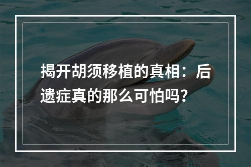 揭开胡须移植的真相：后遗症真的那么可怕吗？