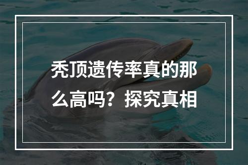 秃顶遗传率真的那么高吗？探究真相