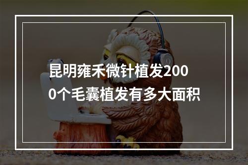 昆明雍禾微针植发2000个毛囊植发有多大面积