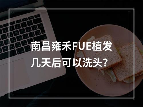 南昌雍禾FUE植发几天后可以洗头？