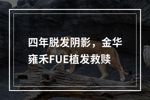 四年脱发阴影，金华雍禾FUE植发救赎