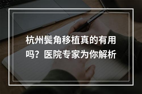 杭州鬓角移植真的有用吗？医院专家为你解析