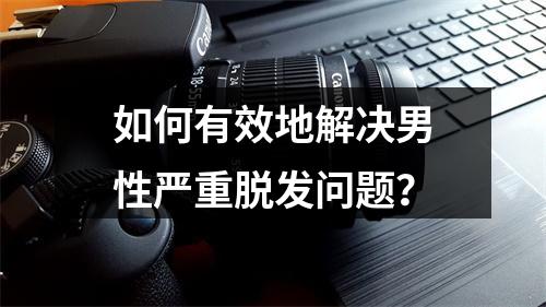 如何有效地解决男性严重脱发问题？