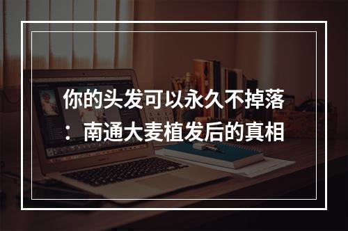 你的头发可以永久不掉落：南通大麦植发后的真相