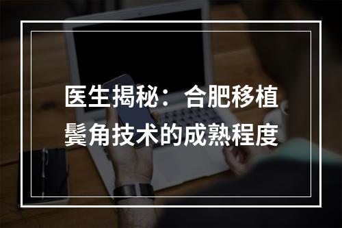 医生揭秘：合肥移植鬓角技术的成熟程度