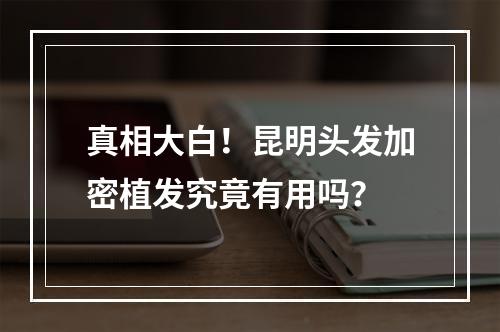 真相大白！昆明头发加密植发究竟有用吗？