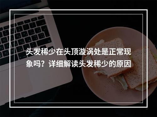 头发稀少在头顶漩涡处是正常现象吗？详细解读头发稀少的原因