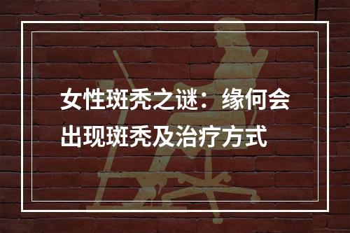 女性斑秃之谜：缘何会出现斑秃及治疗方式