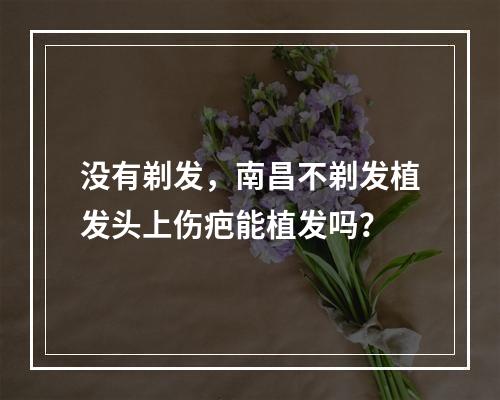 没有剃发，南昌不剃发植发头上伤疤能植发吗？