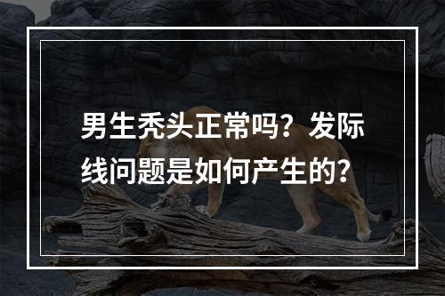 男生秃头正常吗？发际线问题是如何产生的？