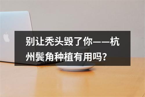 别让秃头毁了你——杭州鬓角种植有用吗？