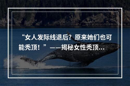 “女人发际线退后？原来她们也可能秃顶！”——揭秘女性秃顶的神秘面纱