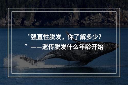 “强直性脱发，你了解多少？”——遗传脱发什么年龄开始