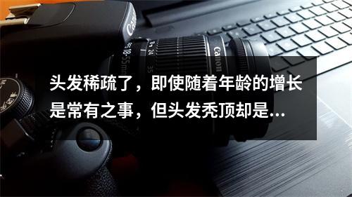 头发稀疏了，即使随着年龄的增长是常有之事，但头发秃顶却是更加严重的问题。而许多人将这个问题称为“遗传性脱发”。